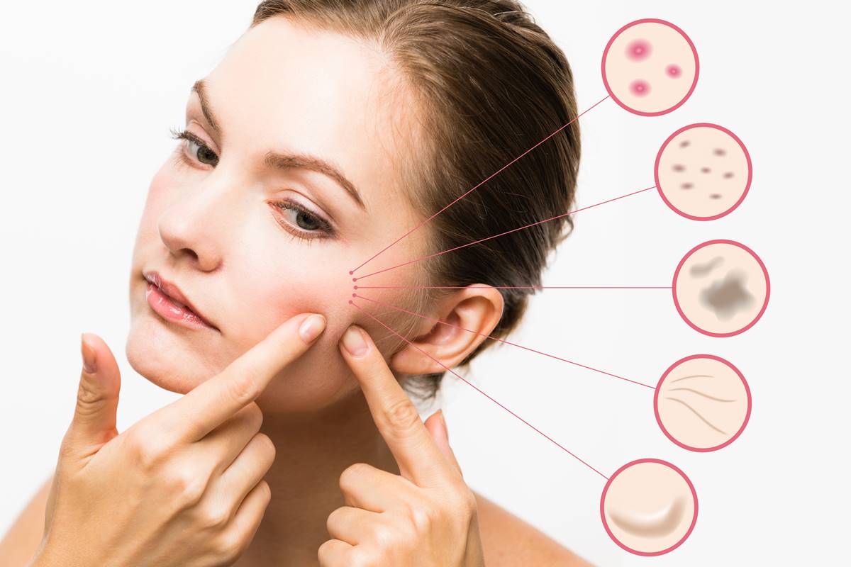 Acne And Pimple Treatment